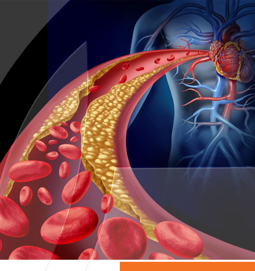 El Antes Síndrome Metabólico, y el Ahora Síndrome Cardio-Metabólico